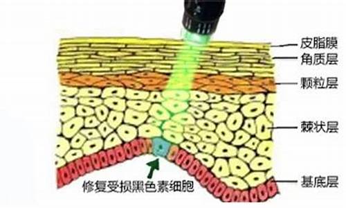 白癜风治疗方法黑枸杞有用吗_黑枸杞能治白斑吗